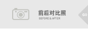 수술전후사진